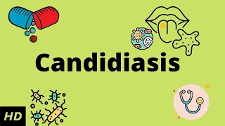 CANDIDIASIS Causes Signs and Symptoms Diagnosis and Treatment [upl. by Stringer701]