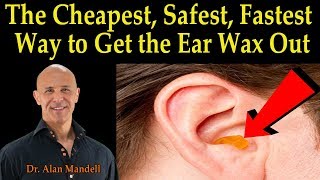 Top 5 Causes of Itchy Ears and Treatment Too [upl. by Johnna]