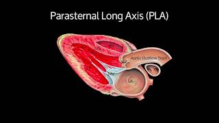 Guidelines for Performing a Comprehensive TTE in Adults Webinar [upl. by Eno]