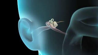 PusFilled Ear Abscess Drained  Revisited Popping [upl. by Nylehtak]