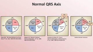 Understanding Echo Standard Imaging Views [upl. by Eittam]