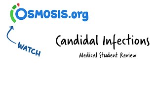 Candidal Infections Osmosis Study Video [upl. by Rosabella]