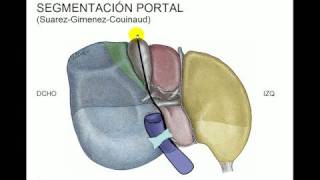 Segmentacion hepática [upl. by Anihpled]