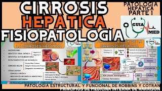 CIRROSIS HEPÁTICA FISIOPATOLOGÍA  GuiaMed [upl. by Ado783]