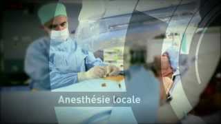 Radiologie interventionnelle  la gastrostomie [upl. by Good]