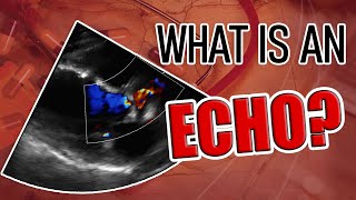 Echocardiography Essentials Detecting pericardial effusions [upl. by Aniles729]