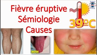 Fièvre éruptive Sémiologie Éruption erythemato maculo papuleuse vésiculeuse purpura Toxidermie [upl. by Aisayt]