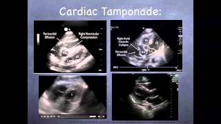 Tutorial Basic echocardiography [upl. by Michi]