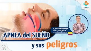 Trastorno del sueño Apnea del sueño síntomas diagnostico y tratamiento [upl. by Ydur]