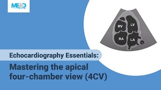 What is an Echocardiogram [upl. by Eillor]