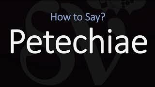 How to Pronounce Petechiae CORRECTLY Meaning amp Pronunciation [upl. by Vinna243]