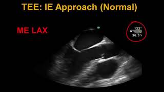 Bedside Ultrasound Basic Cardiac US [upl. by Eveivaneg]