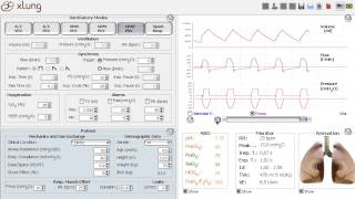 Noninvasive ventilation for COPD acute exacerbation [upl. by Scever]