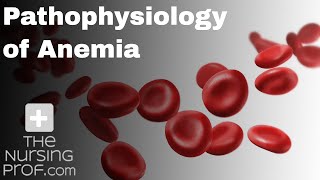 Pathophysiology of Anemia [upl. by Kcirej]