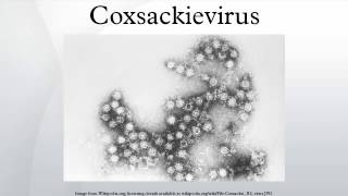 Coxsackievirus [upl. by Yllrebmik]