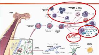 Aplastic Anemia Approach on Diagnosis and Treatment Options 2018 [upl. by Waylen111]