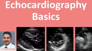 Echocardiography Basics [upl. by Brade]