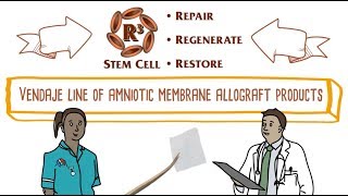 Placental Based Allografts From Womb to Wound [upl. by Rehportsirhc120]