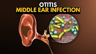 How the Inner Ear Balance System Works  Labyrinth Semicircular Canals [upl. by Sidnarb]