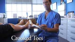 Spread Your Toes™ Series Crooked amp Overlapping Toes Conservative Care vs Conventional Care [upl. by Asillim]