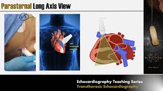 Intro to EKG Interpretation  Waveforms Segments and Intervals [upl. by Neladgam164]