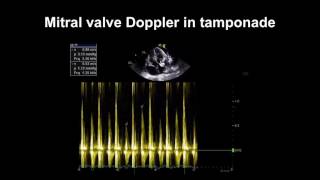 Lecture 2  Transthoracic Echocardiography Part 1 [upl. by Aurie]