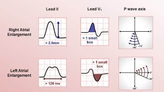 Intro to EKG Interpretation  Rate and Axis [upl. by Anassor]