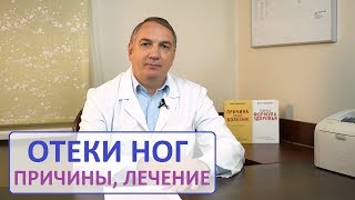 ОТЁКИ ног причины и лечение Отекают ноги – как лечить  Как снять отек на ногах [upl. by Beka]