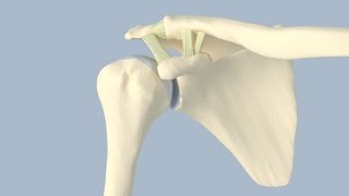 Meniscus Allograft Transplant  CONMED Animation [upl. by Eelimaj54]