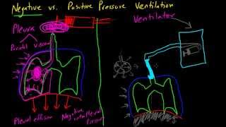 Negative vs Positive Pressure Ventilation [upl. by Aney108]