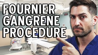 Fournier Gangrene Procedure  Brace Yourselves For This Story [upl. by Farlee]