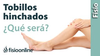 ¿Tienes los tobillos y piernas hinchadas  ¿Será edema venoso o linfático [upl. by Ativad]