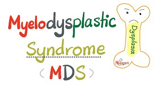 Myelodysplastic Syndrome MDS  a precursor to Acute Myeloid Leukemia AML   Hematology Series [upl. by Johannessen]