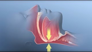 Guía para el uso del CPAP  Intermountain Homecare CPAP Spanish [upl. by Oconnor]