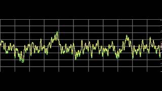 Candidiasis Candida Albicans  Rife Frequencies [upl. by Naivaj259]